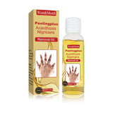 Acanthosis Nigricans Removal Oil, Exfoliating Light Black Brightening And Beauty Skin Oil - V.I.P Digital Presence