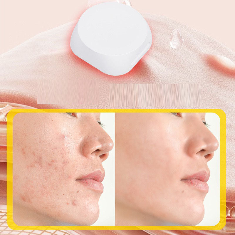 Electronic acne patch with red and blue light buttons acne removal patch with acne print water-based gel acne cleaning patch - V.I.P Digital Presence
