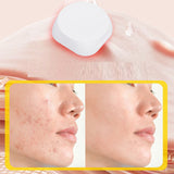 Electronic acne patch with red and blue light buttons acne removal patch with acne print water-based gel acne cleaning patch - V.I.P Digital Presence