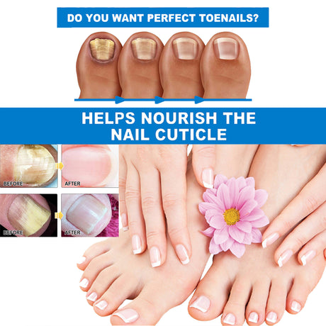 Premium Dietary Supplement, Fade Out Fine Lines Wrinkles Nourish Hair, Repair Nail Thickening Of Light Armor - V.I.P Digital Presence