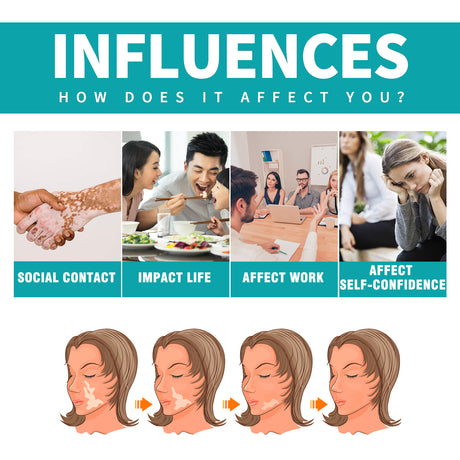 Vitiligo Fix Revitalizing Elixir, Lighten Skin Spots Even Skin Tone Moisturizing Body Care Repair Cream - V.I.P Digital Presence