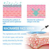 Niacinamide Facial Essence, Brightening, Firming, Hydrating And Whitening Essence - V.I.P Digital Presence