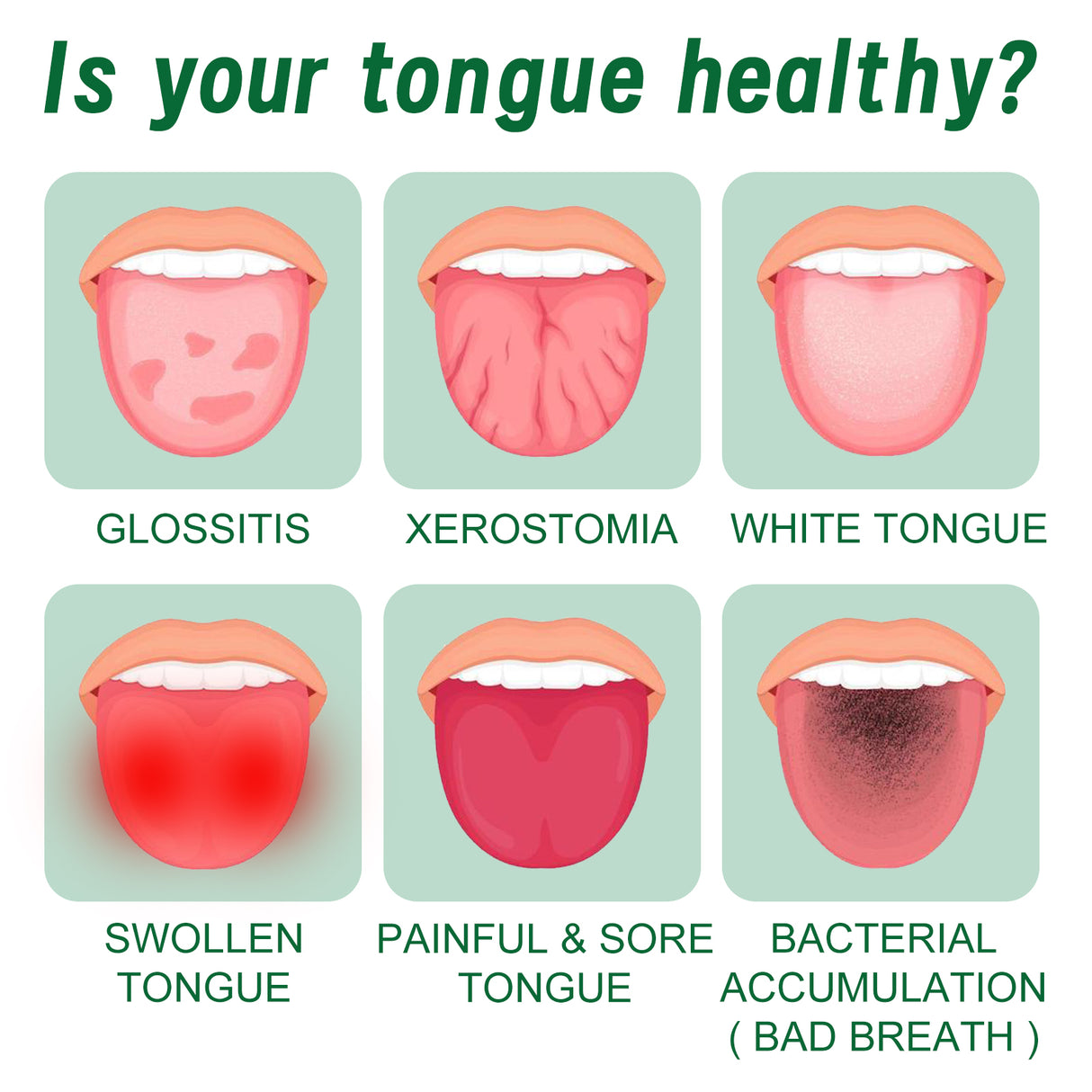 Tongue Repair Spray Repair Tongue Whitening To Relieve Dry, Cracked And Swollen Tongue Oral Care Spray - V.I.P Digital Presence