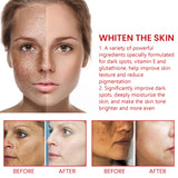Dark Spot Repair Cream, Restores Dull Skin, Lightening Fine Lines And Dark Spots, Brightening Skin Repair Cream - V.I.P Digital Presence