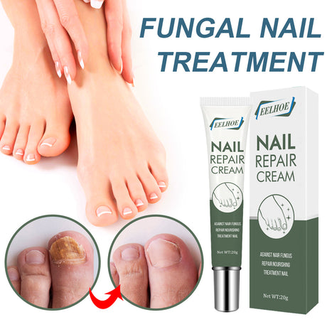 Foot Care And Thickening Nail Repair Cream. Nail Repair Cream - V.I.P Digital Presence