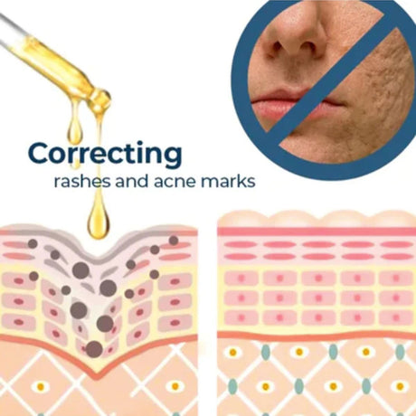 Turmeric Whitening Spot Serum, Lighten Freckle Spots Brightening Skin Hydrating Serum - V.I.P Digital Presence