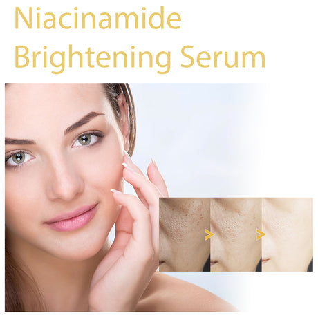 HOYGI Niacinamide Brightening Serum, Lightening Spots And Fine Lines Brightening Skin Hydrating Moisturizing Facial Treatment - V.I.P Digital Presence