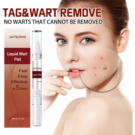 Wart Cream Pen, Skin Tags Gram Warts Fade Moles Corns Smooth Moisturizing Skin Repair - V.I.P Digital Presence