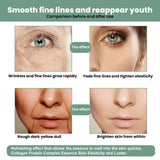 Collagen Anti-Aging Serum, Hydrates Reduces Fine Lines And Firming Skin Care Essence - V.I.P Digital Presence