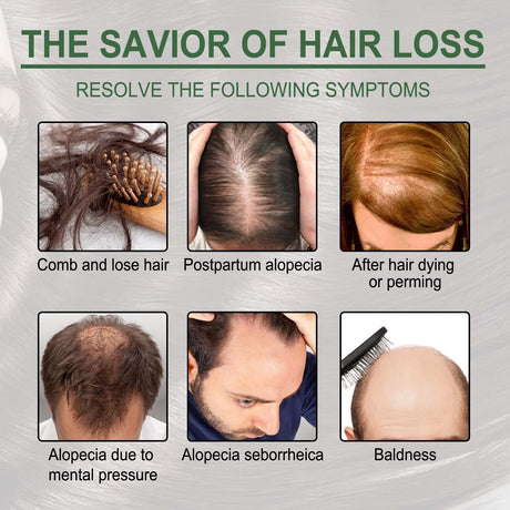 Rosemary Oil Capsules, Nourish Hair Roots Prevent The Loss Of Solid Hair And Hair Moisturizing Hair Care Essential Oil - V.I.P Digital Presence