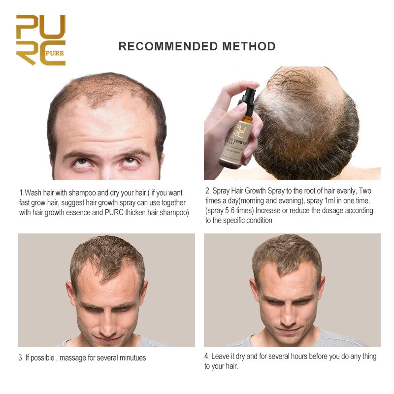 Purc 30ml Hair Growth Spray Natural Ginger Essence Spray Effective Extract Anti Hair Loss Nourish Root Hair Care Treatment - V.I.P Digital Presence