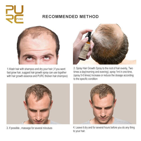 Purc 30ml Hair Growth Spray Natural Ginger Essence Spray Effective Extract Anti Hair Loss Nourish Root Hair Care Treatment - V.I.P Digital Presence