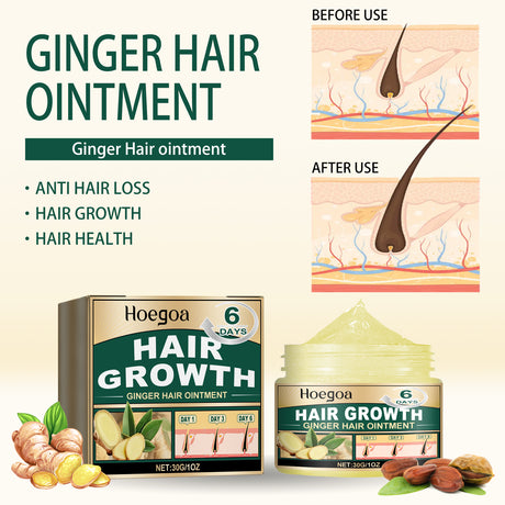 Ginger Hair Ointment, Care For Hair Follicles, Strengthen Hair, Moisturize Hair, Prevent Hair Breakage And Dense Hair Care Cream - V.I.P Digital Presence