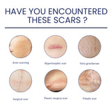 Scar Gel, Fade Skin Scar Pregnancy Surgery Scar Moisturizing Skin Care Gel - V.I.P Digital Presence