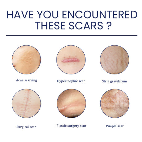 Scar Gel, Fade Skin Scar Pregnancy Surgery Scar Moisturizing Skin Care Gel - V.I.P Digital Presence