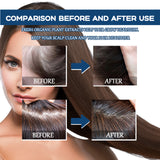 EAST MOON Hair Treatment Spray Moisturizes And Softens Hair, Prevents Loose Hair And Thickens Hair Treatment Spray - V.I.P Digital Presence