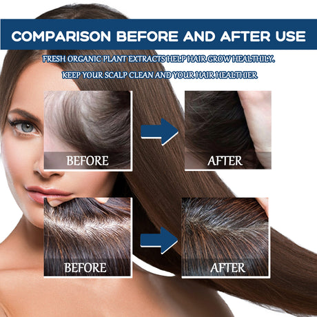EAST MOON Hair Treatment Spray Moisturizes And Softens Hair, Prevents Loose Hair And Thickens Hair Treatment Spray - V.I.P Digital Presence
