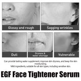 Egf Face Tightener Serum, Lighten Fine Lines Deep Hydrating Firming And Moisturizing Facial Essence