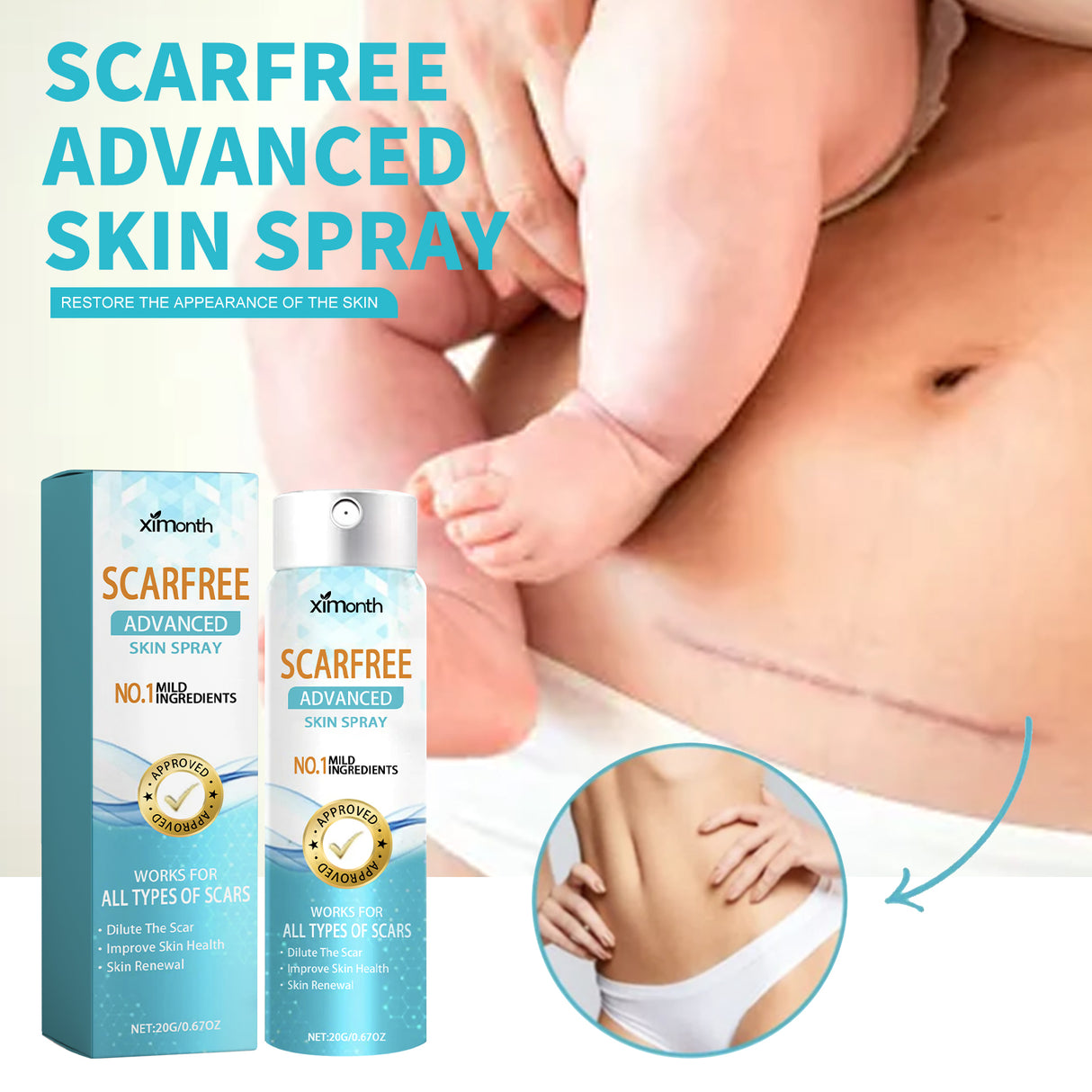 Scarfree Advanced Skin Spray, Body Skin Care Reduces Post-Natal Scars And Smooths Skin - V.I.P Digital Presence