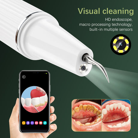 3-Speed Visible Ultrasonic Electric Tooth Cleaner Tooth Cleaning Beauty Instrument To Remove Tartar And Calculus Tooth Cleaning Device - V.I.P Digital Presence