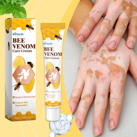 Bee Venom White Spot Care Cream Bee Venom Repair Skin Moisturizing Skin Care Topical Cream - V.I.P Digital Presence
