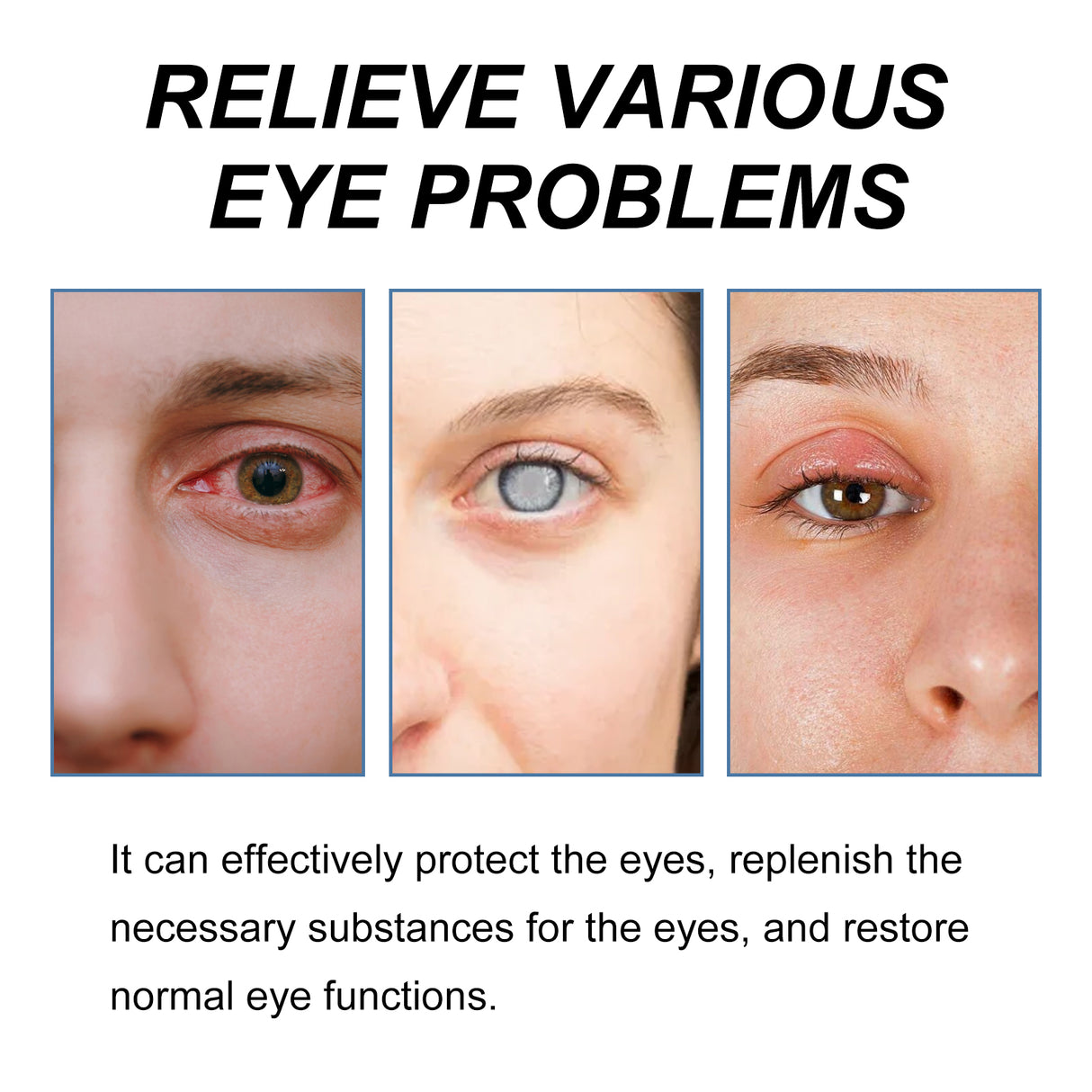 Myopia Reversal Eye Drops, Relieve Eye Discomfort Repair Eye Fatigue And Dry Eye Moisturizing Lotion - V.I.P Digital Presence