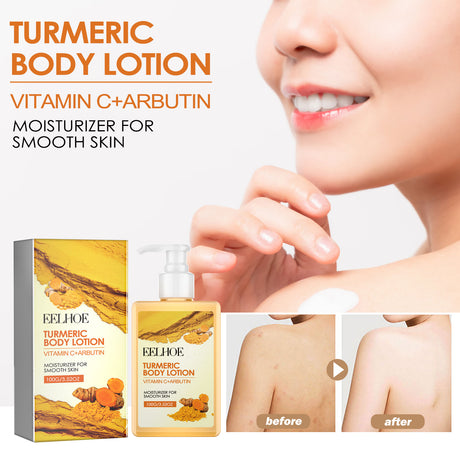 Turmeric Body Lotion, Moisturizing And Moisturizing Whitening Skin Refreshing And Brightening Winter Skin Care Body Lotion - V.I.P Digital Presence