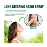 Lung Clearing Nasal Spray, Relieve Nasal Congestion, Runny Nose And Nasal Discomfort Cleansing Stop Snoring Spray - V.I.P Digital Presence