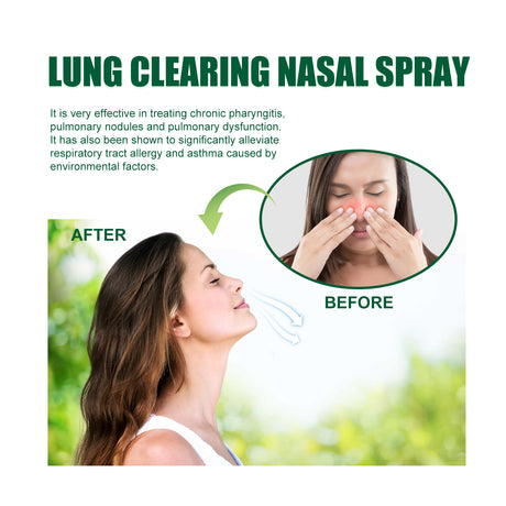 Lung Clearing Nasal Spray, Relieve Nasal Congestion, Runny Nose And Nasal Discomfort Cleansing Stop Snoring Spray - V.I.P Digital Presence