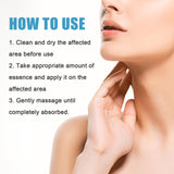 Scar Repair Serum Lightens Post-Pregnancy Scar Repair And Smoothes Body Skin - V.I.P Digital Presence