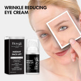 Eye Care Cream Hydrates And Tights The Skin Around The Eyes With An Even Brightening Eye Cream - V.I.P Digital Presence