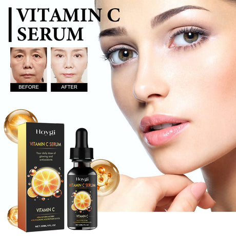 Vitamin C Serum, Deep Moisturizing And Moisturizing Whitening Essence For Subtle Spots And Fine Lines - V.I.P Digital Presence