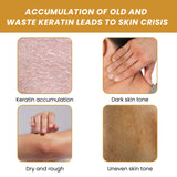 Turmeric Sugar Body Scrub, Fade Acne Mark Moisturizing Refreshing Smooth Tender Skin Cleansing Body Exfoliating Scrub - V.I.P Digital Presence