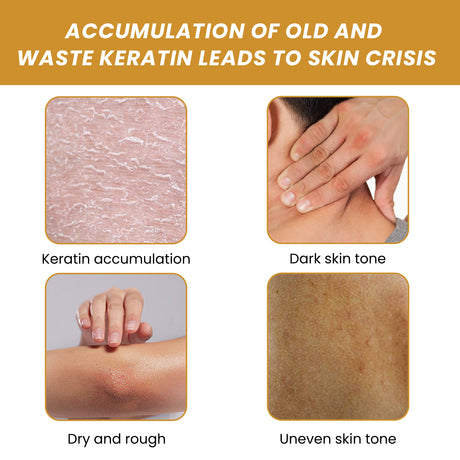 Turmeric Sugar Body Scrub, Fade Acne Mark Moisturizing Refreshing Smooth Tender Skin Cleansing Body Exfoliating Scrub - V.I.P Digital Presence