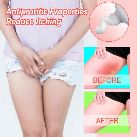 Heat Rash Treatment Cream, Alleviate The Uncomfortable Itching Clean Body Odor Care Cream For External Use Only - V.I.P Digital Presence