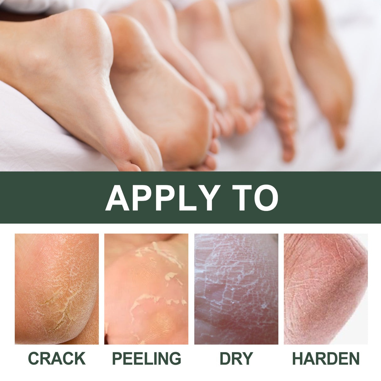 Anti-Crack Hand And Foot Care Cream Moisturizes Skin To Prevent Dry Cracking, Peeling, Freezing And Chapping