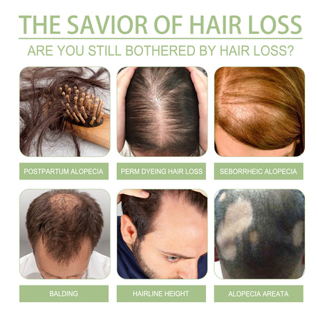 Herbal Hair Care Oil Gently Nourishes Scalp, Strengthens Hair, Cleanses Scalp, Softens Hair Care Oil - V.I.P Digital Presence