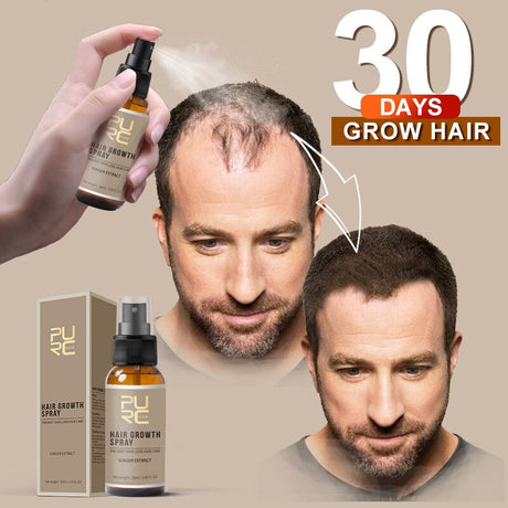 Purc 30ml Hair Growth Spray Natural Ginger Essence Spray Effective Extract Anti Hair Loss Nourish Root Hair Care Treatment - V.I.P Digital Presence