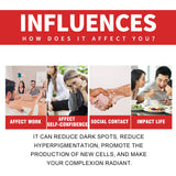 Dark Spot Whitening Cream, Lightening Yellow Brown White Spot Cream Dark Spots Correct Skin Tone Moisturize Skin Whitening - V.I.P Digital Presence