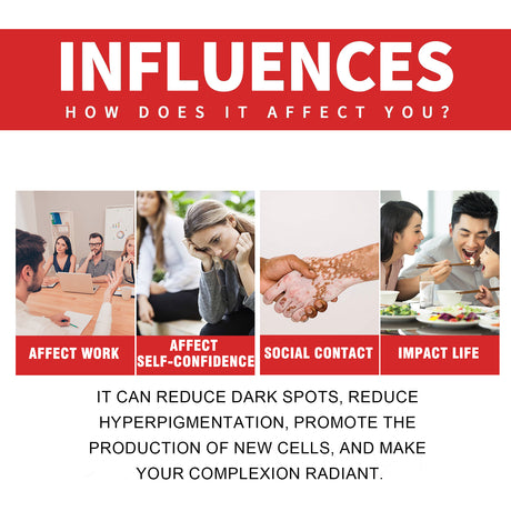 Dark Spot Whitening Cream, Lightening Yellow Brown White Spot Cream Dark Spots Correct Skin Tone Moisturize Skin Whitening - V.I.P Digital Presence