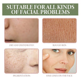 5% Niacinamide Serum, Chun White Tender Skin Fade Spots Brighten Moisturizing Skin Fine Pores - V.I.P Digital Presence