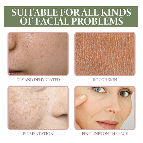 5% Niacinamide Serum, Chun White Tender Skin Fade Spots Brighten Moisturizing Skin Fine Pores - V.I.P Digital Presence