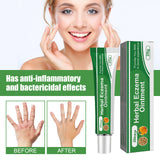 Herbal Eczema Ointment, Relieve Hand And Foot Moss Skin Redness Itchy Skin Repair Ointment - V.I.P Digital Presence