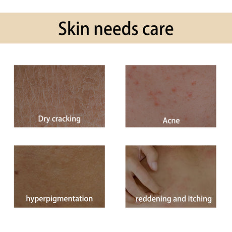 Handcrafted Body Oil, Body Massage Moisturizing Firming And Tender Skin Care Essential Oil - V.I.P Digital Presence