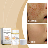 Skin Care Stick, Repair And Moisturize Skin, Reduce Dullness And Rejuvenate Skin Care Stick - V.I.P Digital Presence