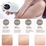 All-In-One Machine For Hair Removal Skin Rejuvenation And Acne Removal - V.I.P Digital Presence