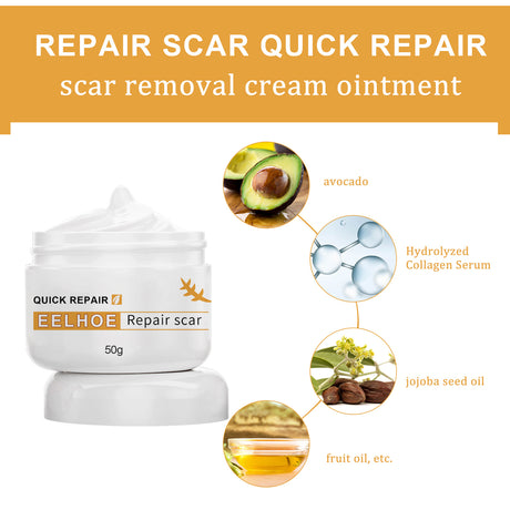 Desalting Skin Scar Cream, Skin Burn Scalding Surgical Scar Wound Repair Cream - V.I.P Digital Presence