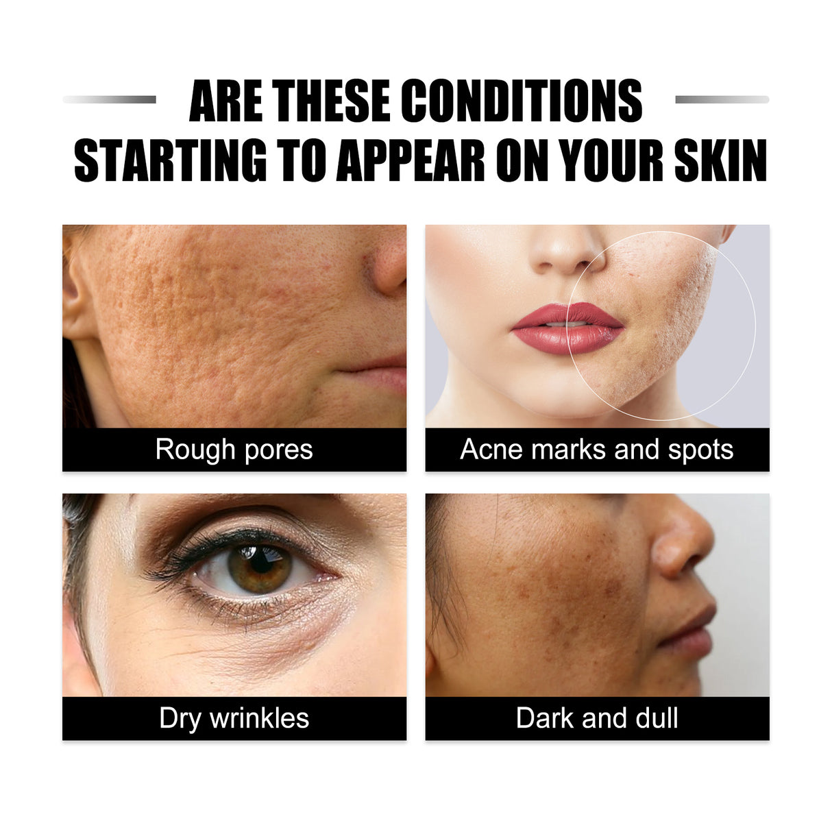 Ginseng Snail Essence, Brightening Skin Moisturizing And Repairing Dull Skin And Anti-wrinkle Essence