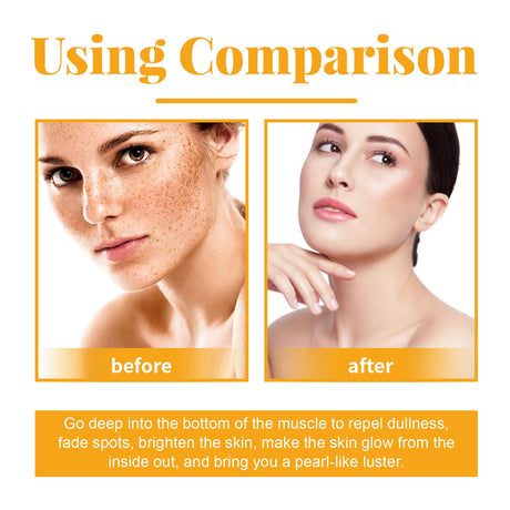 Ouhoe Fruit Acid Facial Body Essence Series, Moisturizing, Moisturizing, Brightening And Firming Skin Essence - V.I.P Digital Presence