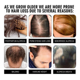 Hair Conditioning Essence, Repair Dull Smooth Hair And Scalp Massage Treatment Hair Conditioning Essence - V.I.P Digital Presence